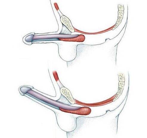 The penis is not trained pubic muscles and then