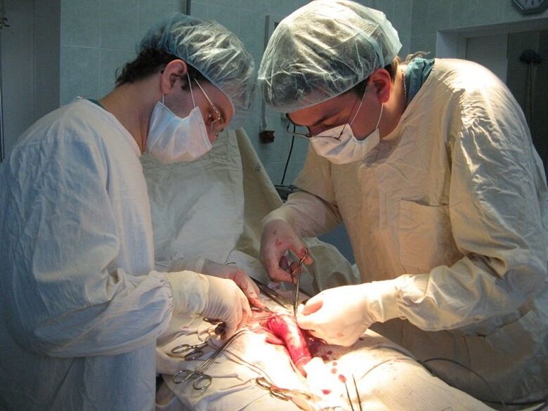 Perform ligament cutting - surgery to increase penis length